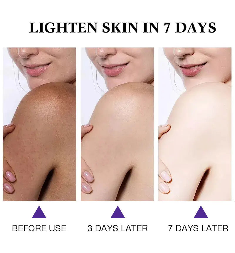 Papaya Kojic Acid Body Oil Deeply nourishes skin moisturizes fades dark spots evens tone absorbs fast enhances natural glow