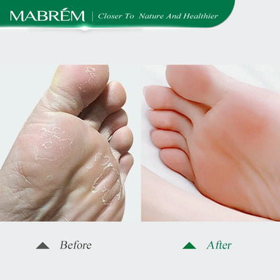 MABREM Foot Treatment Cream Whitening Anti-cracking Moisturizing Foot Care Exfoliating Scrub Anti-dry Calendula Olive Repair 40g