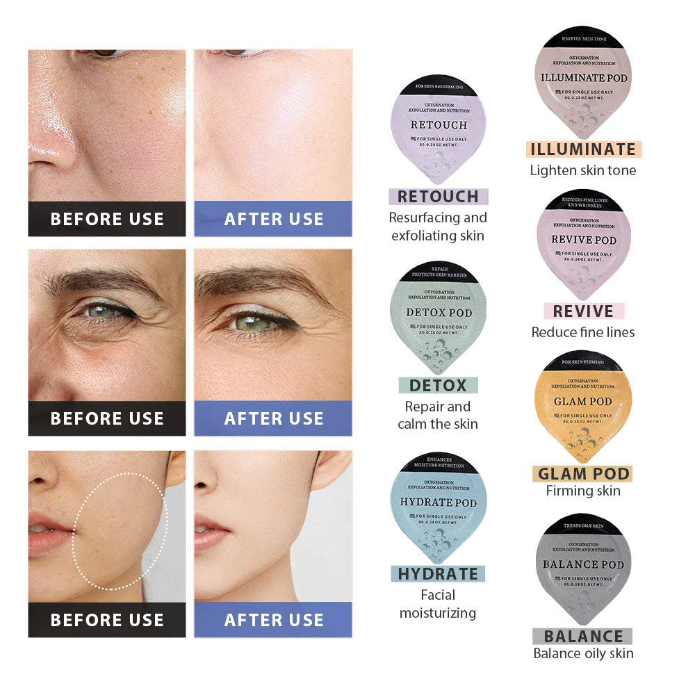 Foreverlily 5 pcs CO2 Pods Set For CO2 Bubble Pen Aqua Face Cleaning CO2 Capsule Gels Facial SPA Beauty Restart Kit Skin Care