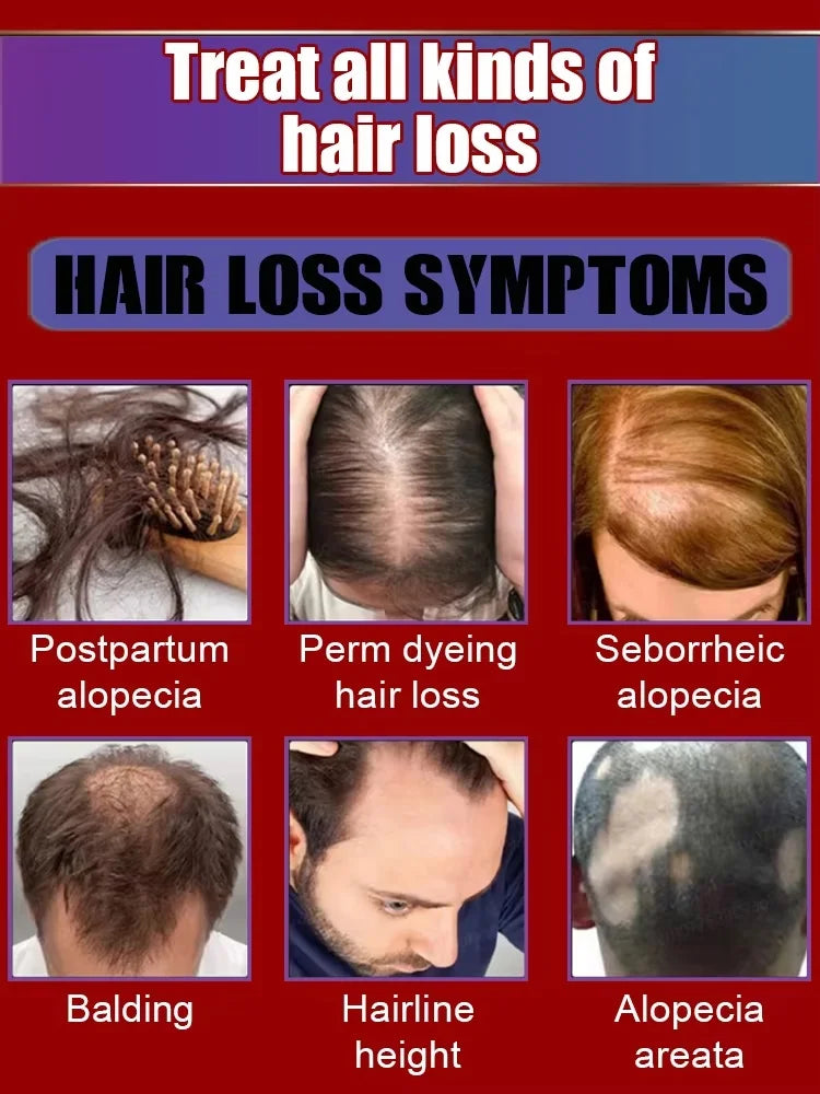 ᵀʰⁱᶜᵏ ʰᵃⁱʳ⸴ ᵗʰⁱᶜᵏ ᵇᵉᵃʳᵈ⸴ ᵗʰⁱᶜᵏ ˡᵉᵍ ʰᵃⁱʳ⸴ ᵗʰⁱᶜᵏ ᶜʰᵉˢᵗ ʰᵃⁱʳ