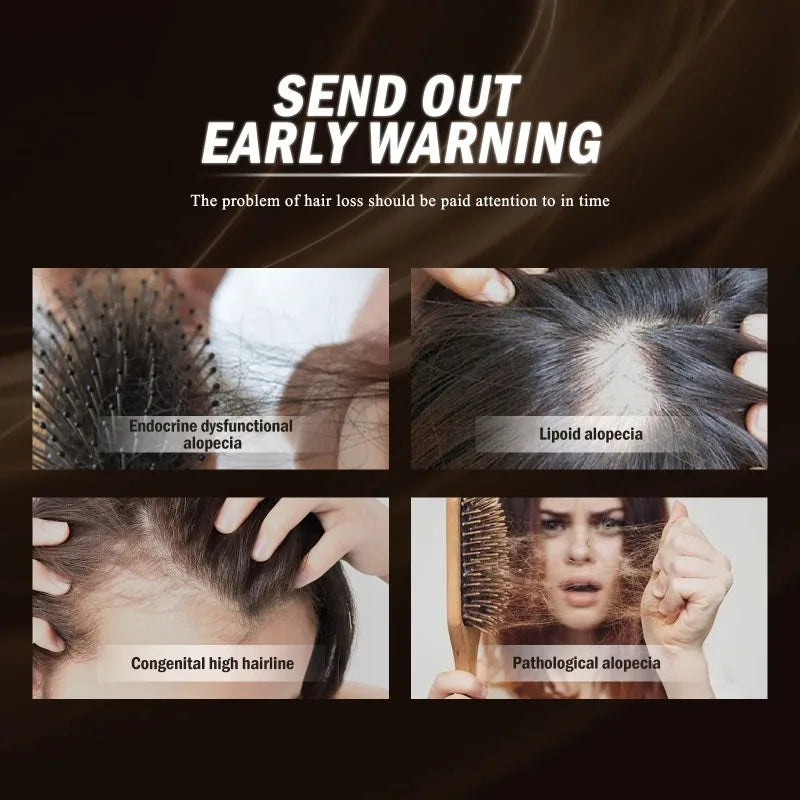 Hair Growth Serum Spray Ginger Anti Hair Loss Treatment Products Repair Nourish hair Roots Fast Regrowth Men Women