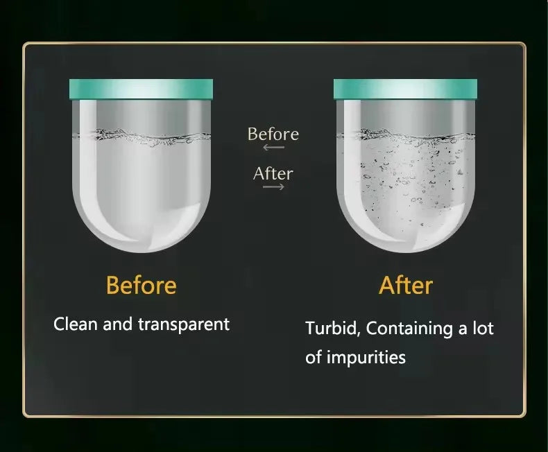 3 in 1 Blackhead Removal Facial Moisturizing Hydro Oxygen Spray Jet Peel Microdermabrasion Micro Bubble Machine