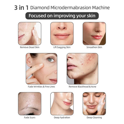 Facial Diamond Microdermabrasion Machine Water Spray Exfoliation Beauty Home Use Blackhead Exfoliation Face Peeling Pore Clean