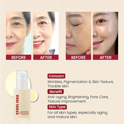 Seoul 1988 Anti-Aging Trio: 4% Retinal Eye Cream + 2% Retinal Serum w/ Black Ginseng for Wrinkles & Brightening,Korean Skincare
