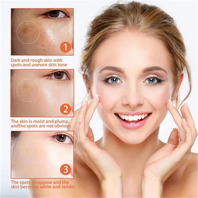 Effective Whiten Cream Brighten Face For Face Spots Remove Dark Spot Melasma Anti-pigmentation Improve Dullness Skin Care Cream