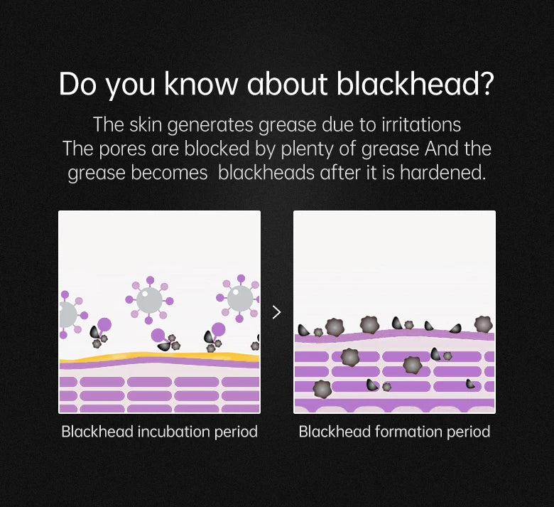 Black Head Remover Face Mask Bamboo Charcoal Black Dot T-zone Deep Cleaning for Women Men Blackhead Facial Skin Care Products