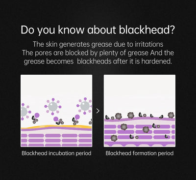 Black Head Remover Face Mask Bamboo Charcoal Black Dot T-zone Deep Cleaning for Women Men Blackhead Facial Skin Care Products