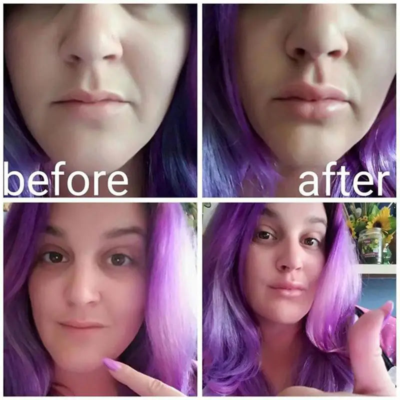 Silicone Labium Fish Shape Lips Tools Women Sexy Lip Plumper Enhancer Tool for Female Girls Natural Pout Thicken Mouth Plump