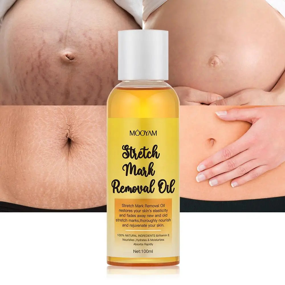 Stretch Mark Removal Oil Removes Postpartum Pregnant Women Scar Repair Obesity Stretch Mark Anti-Aging Firming Serum Skin Care