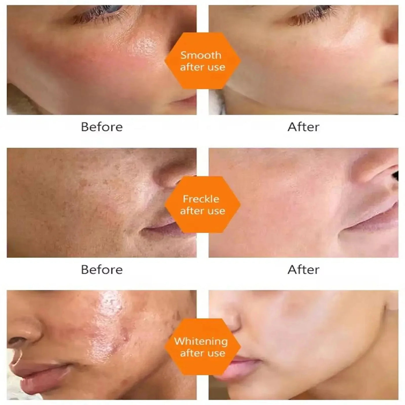 Vitamin C Whitening Serum Remove Freckles Dark Spots Face Essence Fade Melasma Melanin Brighten Repair Dull Skin Care Cosmetics