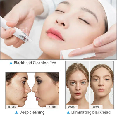 Hydro Water Jet Peel Hydrodermabrasion Machine 6 in 1 Facial Dermabrasion Hydra Skin Whitening Device Facial Skin Care Machine