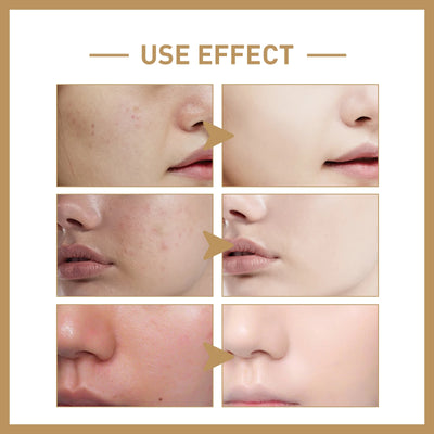 Rice Moisturizing Toner Repairs Damaged Skin Firms Tighter Skin Softens Lines And Wrinkles Shrinks Pores And Brightens Skin Tone