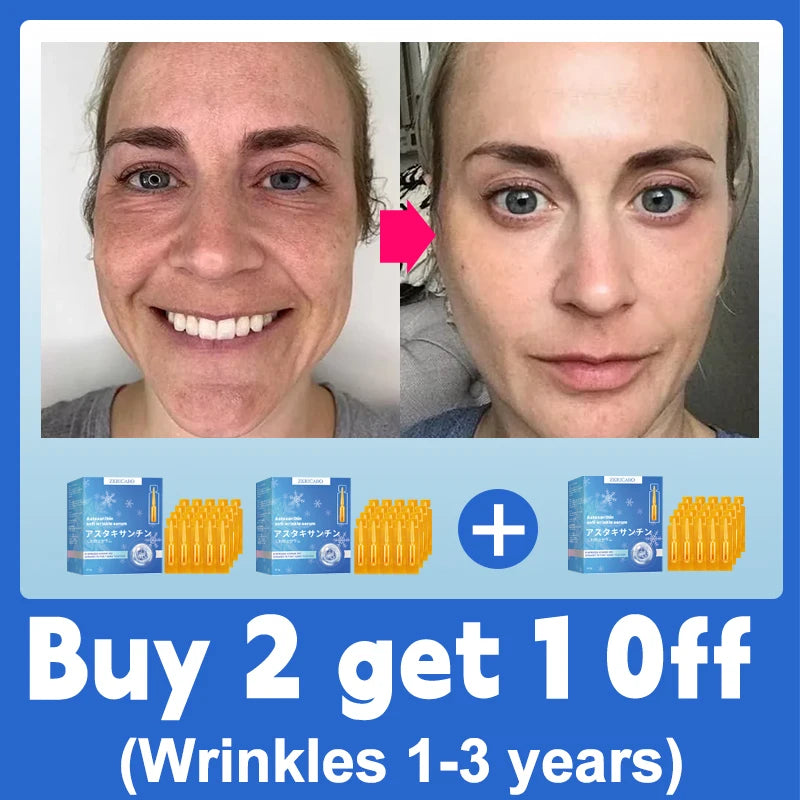 20 ʏᴇᴀʀs ʏᴏᴜɴɢᴇʀ! Aɴᴛɪ-ᴡʀɪɴᴋʟᴇ, ғɪʀᴍɪɴɢ, ʟɪɢʜᴛ ʟɪɴᴇs ʀᴇᴘᴀɪʀ