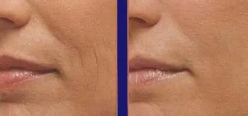 PURE RETINOL SERUM 5% HYALURONIC ACID RETINOL FACE CREAM 30ml Anti-aging Anti-wrinkle Exfoliate Skin Care Firming