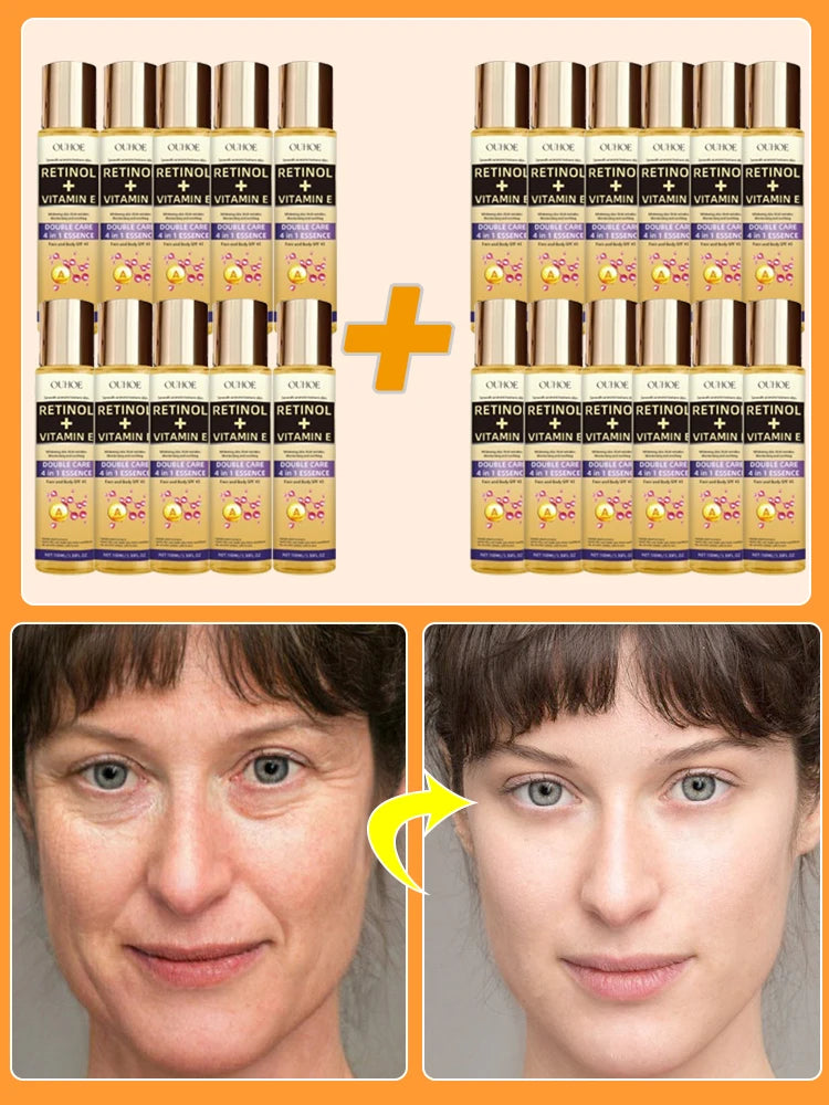 Wrinkles disappear permanently