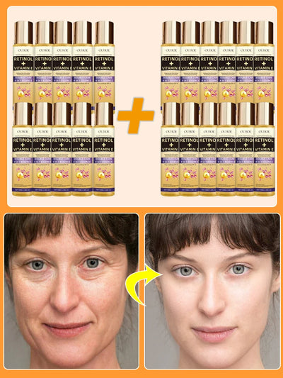 Wrinkles disappear permanently