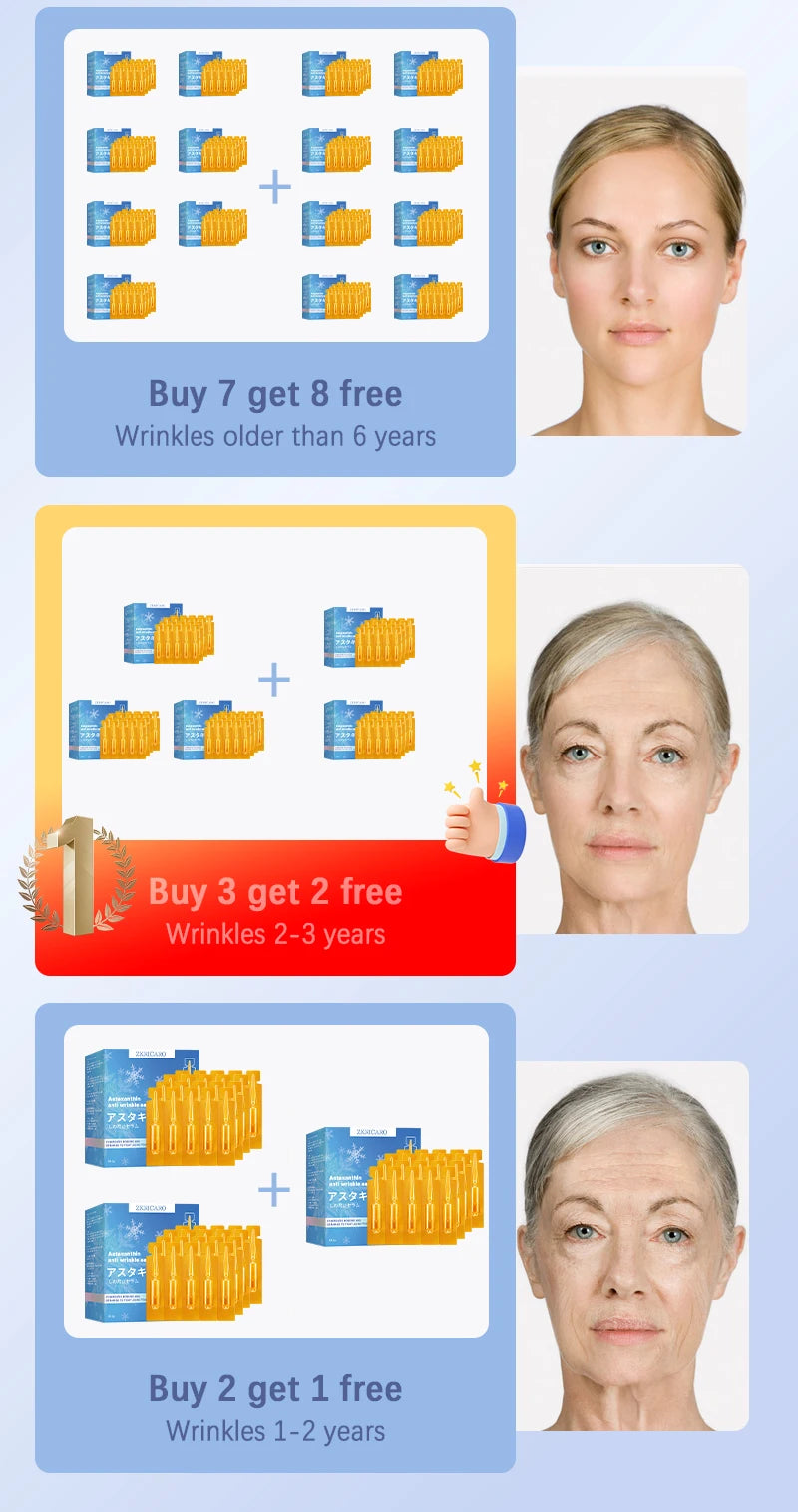 20 ʏᴇᴀʀs ʏᴏᴜɴɢᴇʀ! Aɴᴛɪ-ᴡʀɪɴᴋʟᴇ, ғɪʀᴍɪɴɢ, ʟɪɢʜᴛ ʟɪɴᴇs ʀᴇᴘᴀɪʀ