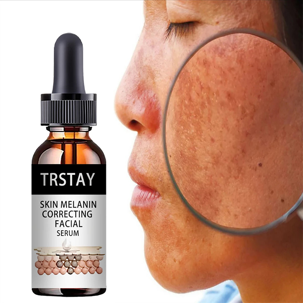 nicotinamide essence removes black spots and acne, improves facial scars, brightens skin tone and revitalizes face