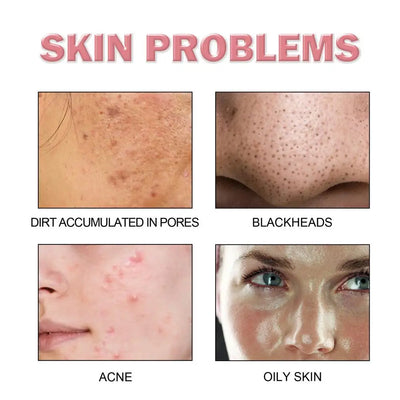 Facial foaming Cleanser Deeply Cleansing Oil Control Moisturizing Blackhead Removal Skin Care Face Wash Foam Cleanser