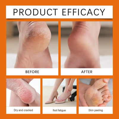 Moisturizing Foot Stick Improve Dry Rough Heel Crack Repair Products Soften Calluses Dead Skin Removal Balm Hydrating Hand Cream