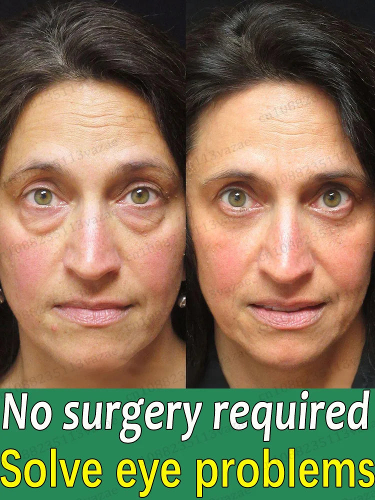 stay up late eye essence,keep your eyes forever young