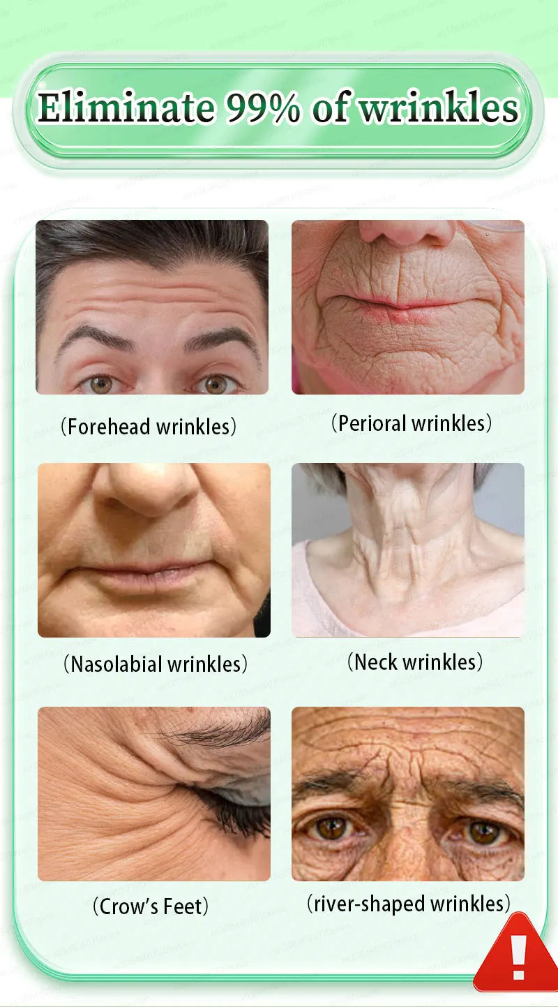 20 years younger，100% wrinkles disappear