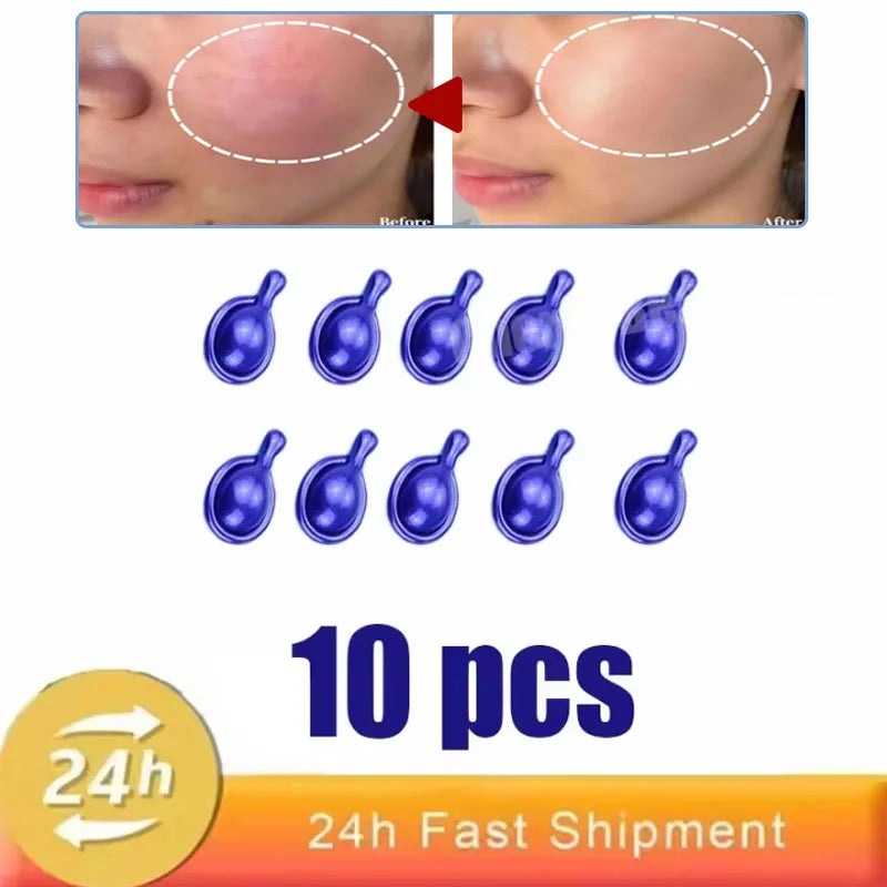 Fast Repair Facial Redness Essential oil Soothing Red Blood Rosacea Improve Sensitive Skin Dryness Moisturizing Korean Cosmetics