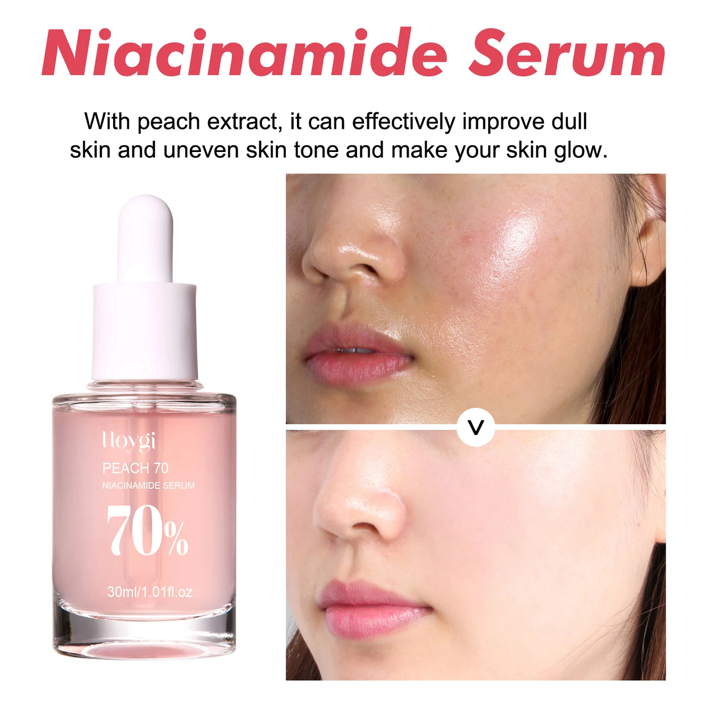 Niacinamide Serum Brightening Complexion Nourishing Hydrating Rejuvenating Serum Pore Contouring Hyaluronic Acid Soothing Skin