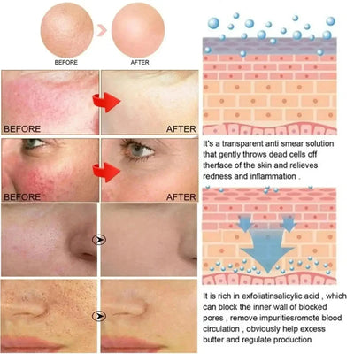 Fast Repair Facial Redness Essential oil Soothing Red Blood Rosacea Improve Sensitive Skin Dryness Moisturizing Korean Cosmetics