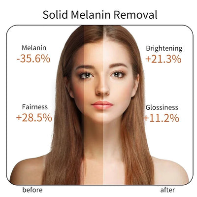 Natural Vitamin Serum Original Face Dark Spot Whitening Brighten Moisturizing VC Essence For Stretch Mark korean skin care