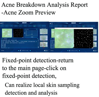 Smart Ice Blue Plus 7 in 1 Oxygen Hydro dermabrasion Bubble Machine Professional Face Hydra Machine rf Lifting ultrason machine