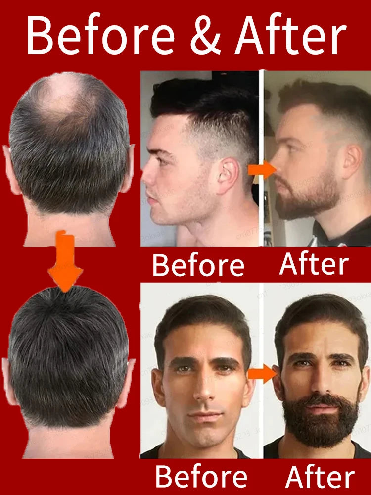 ᵀʰⁱᶜᵏ ʰᵃⁱʳ⸴ ᵗʰⁱᶜᵏ ᵇᵉᵃʳᵈ⸴ ᵗʰⁱᶜᵏ ˡᵉᵍ ʰᵃⁱʳ⸴ ᵗʰⁱᶜᵏ ᶜʰᵉˢᵗ ʰᵃⁱʳ