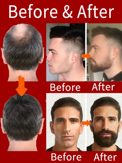 ᵀʰⁱᶜᵏ ʰᵃⁱʳ⸴ ᵗʰⁱᶜᵏ ᵇᵉᵃʳᵈ⸴ ᵗʰⁱᶜᵏ ˡᵉᵍ ʰᵃⁱʳ⸴ ᵗʰⁱᶜᵏ ᶜʰᵉˢᵗ ʰᵃⁱʳ