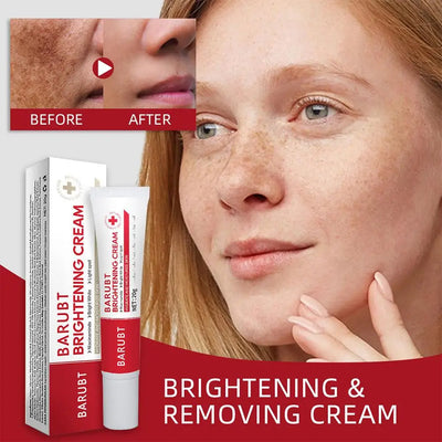 Fades Freckle Dark Spots Face Cream Niacinamide Whitening Cream Vitamin E Improve Dullness Fast Brighten Nourish Skin Care NEW