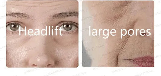 20 ʏᴇᴀʀs ʏᴏᴜɴɢᴇʀ! Aɴᴛɪ-ᴡʀɪɴᴋʟᴇ, ғɪʀᴍɪɴɢ, ʟɪɢʜᴛ ʟɪɴᴇs ʀᴇᴘᴀɪʀ