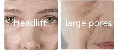 20 ʏᴇᴀʀs ʏᴏᴜɴɢᴇʀ! Aɴᴛɪ-ᴡʀɪɴᴋʟᴇ, ғɪʀᴍɪɴɢ, ʟɪɢʜᴛ ʟɪɴᴇs ʀᴇᴘᴀɪʀ