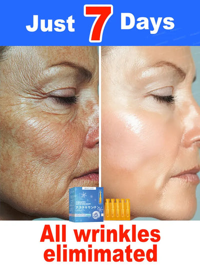 20 ʏᴇᴀʀs ʏᴏᴜɴɢᴇʀ! Aɴᴛɪ-ᴡʀɪɴᴋʟᴇ, ғɪʀᴍɪɴɢ, ʟɪɢʜᴛ ʟɪɴᴇs ʀᴇᴘᴀɪʀ