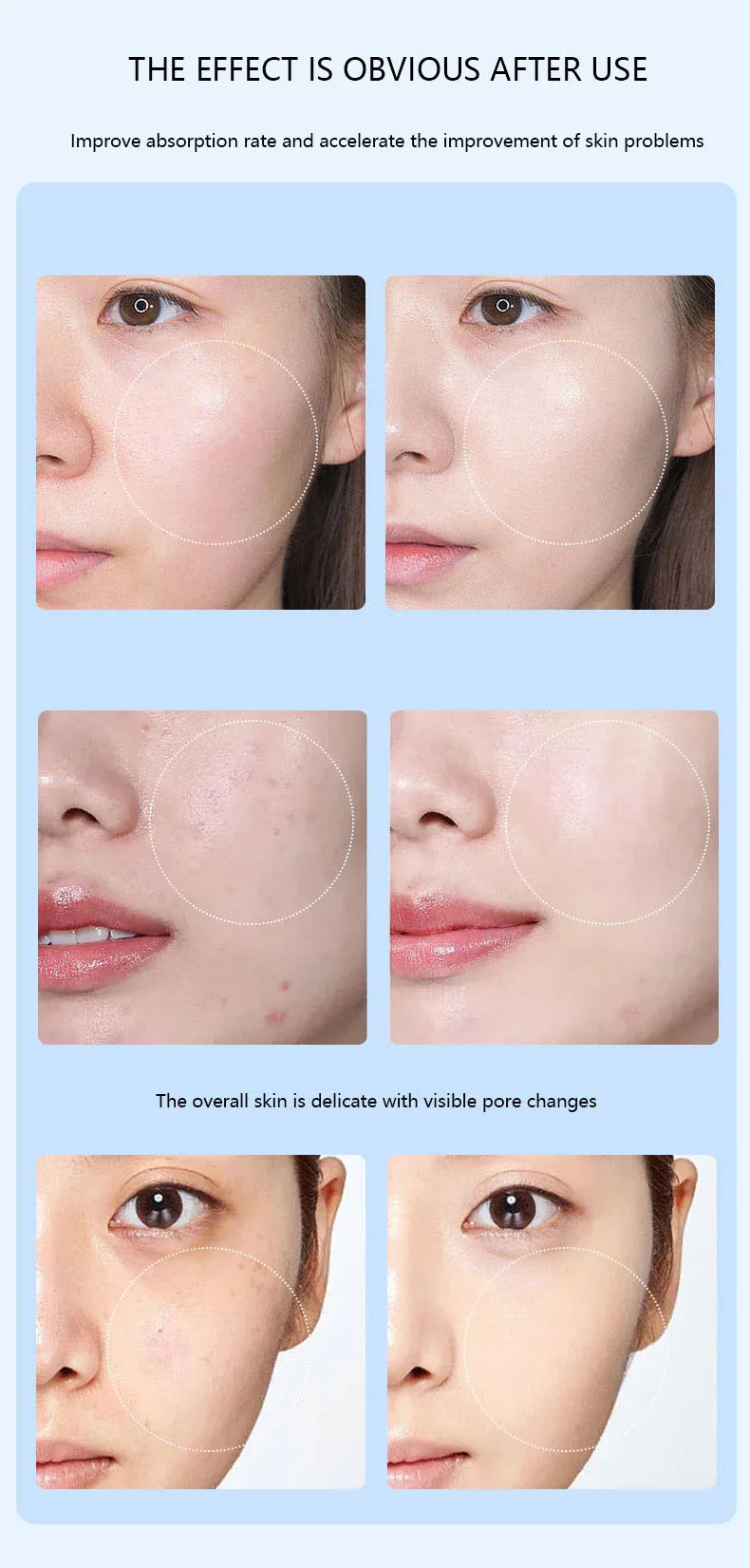 Nano Microneedling Pen Facial Skin Care Product Absorbs Device LED Light Photon Vibration Face Massager Mesogun Serum Applicator