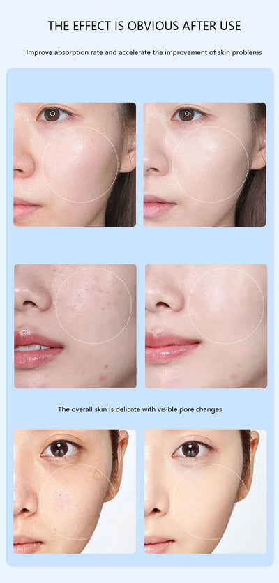 Nano Microneedling Pen Facial Skin Care Product Absorbs Device LED Light Photon Vibration Face Massager Mesogun Serum Applicator