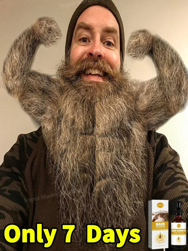 ᵀʰⁱᶜᵏ ʰᵃⁱʳ⸴ ᵗʰⁱᶜᵏ ᵇᵉᵃʳᵈ⸴ ᵗʰⁱᶜᵏ ˡᵉᵍ ʰᵃⁱʳ⸴ ᵗʰⁱᶜᵏ ᶜʰᵉˢᵗ ʰᵃⁱʳ