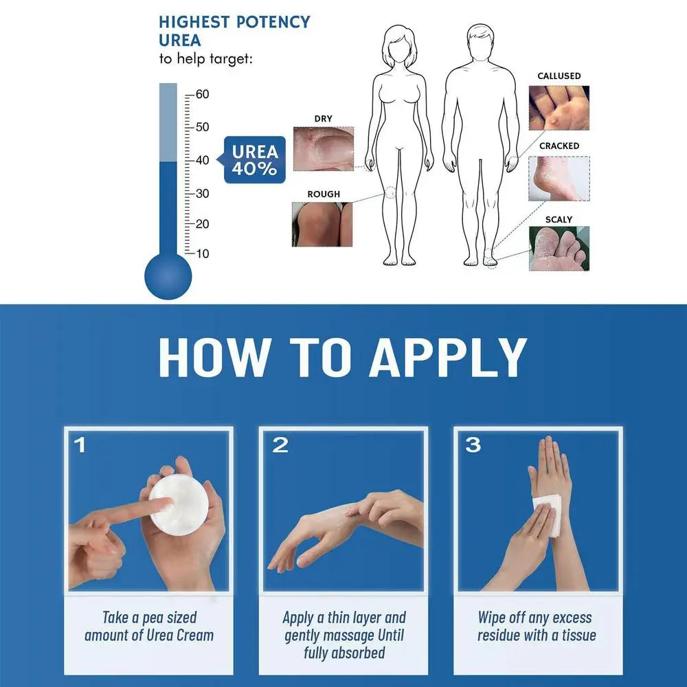 1pcs 150g Urea Cream 40% Urea Cream Anti-dry Cracking Moisturizing Hydration Hand and Foot Cream