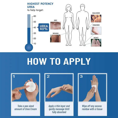 1pcs 150g Urea Cream 40% Urea Cream Anti-dry Cracking Moisturizing Hydration Hand and Foot Cream