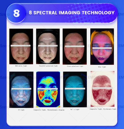 2025 Latest Hot Selling Professional 3D Skin Testing Analyzer Facial Scanning Analyzer Equipment