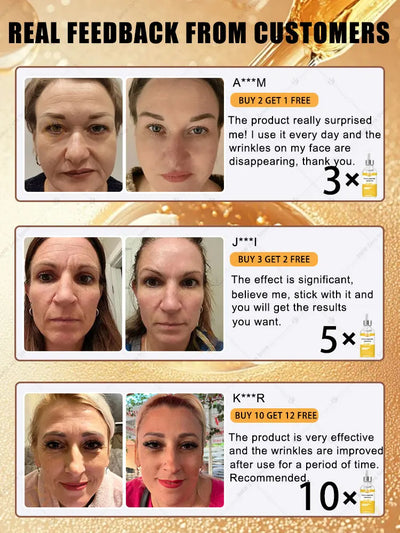 20 years younger, 100% wrinkles disappear