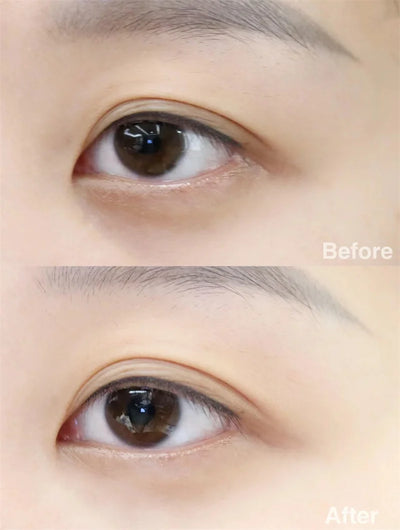 ZS Korean Perfect Real Performance Collagen Eye Mask For Dark Circles & Puffiness Hyaluronic Acid Hydrolyzed Collagen Eye Patch