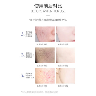 Oligopeptide Lyophilized Powder 5 Pairs Repair Hydration Moisturizing High Active Essence Original Deep Brighten Skin Care