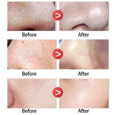 Peel Off Nose Blackhead Remover Mask Deep Cleansing Shrink Pore Acne Treatment Strips Nose Patches Face Skin Care Beauty Tools