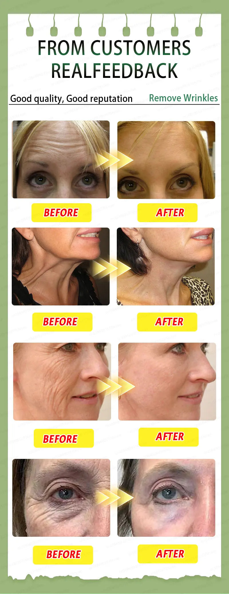 20 years younger，100% wrinkles disappear