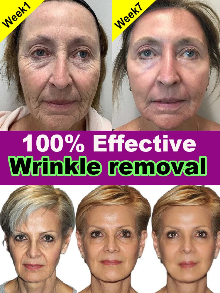 20 years younger，100% wrinkles disappear