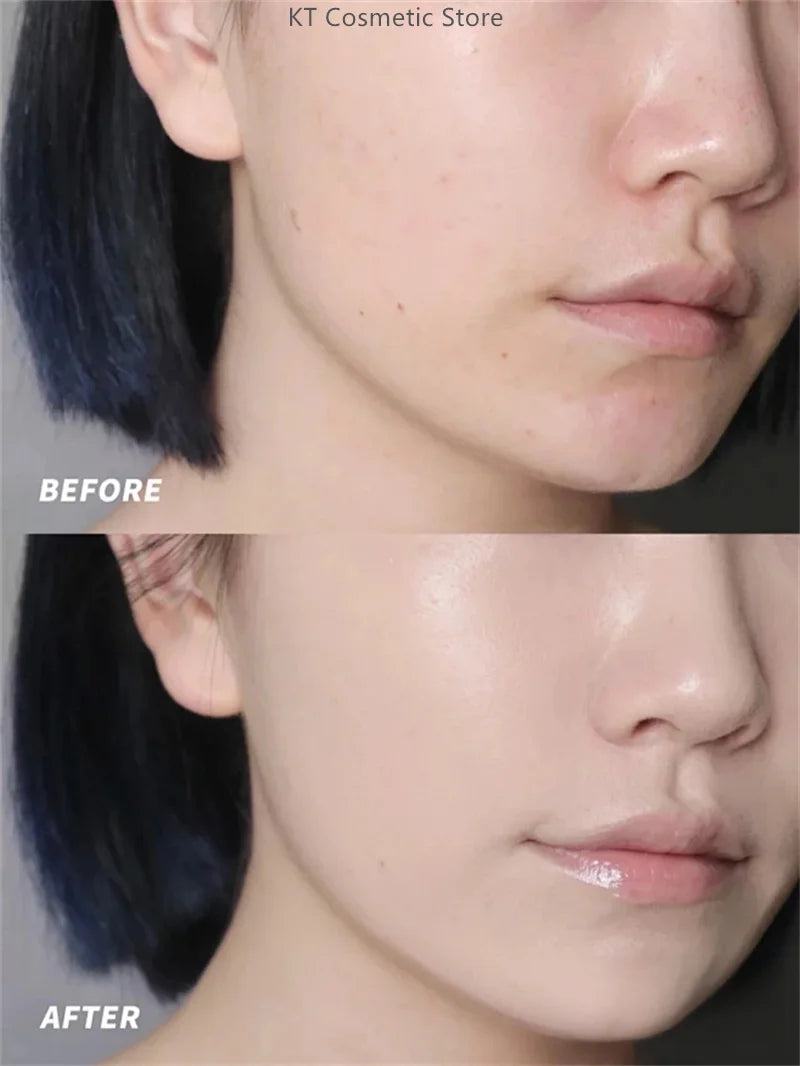 Black White Rice Peel Shot Glow Rice Ampoule Duo Exfoliate Dead Skin Closed Pimples Moisturize Brighten Smooth Pores Care Korea